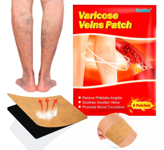 6 patchs pour éliminer les varices.